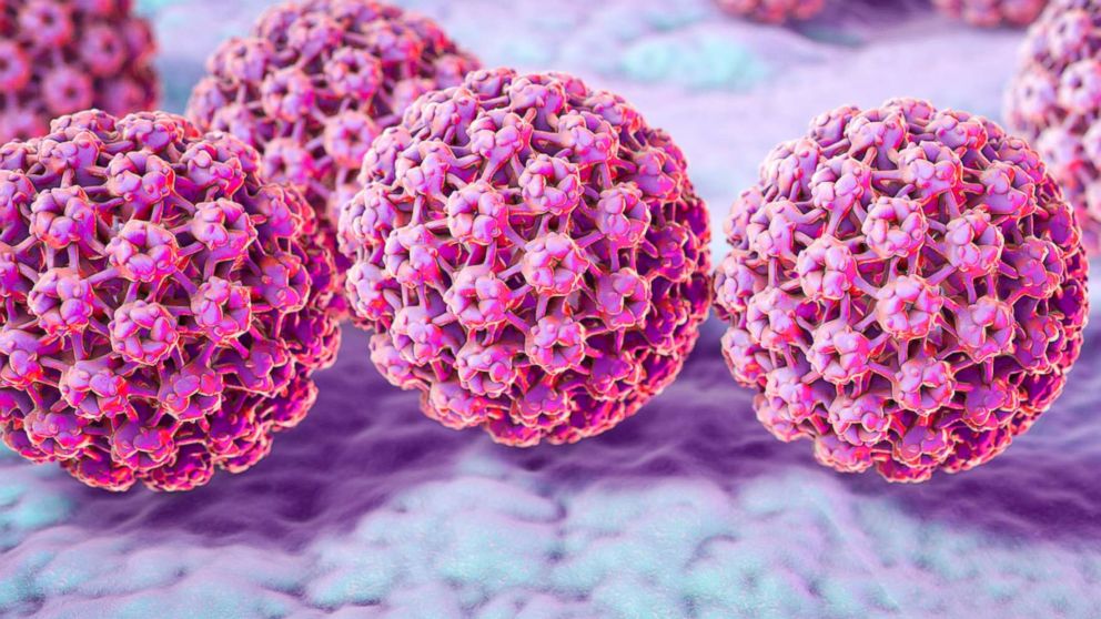 01.07.2021 - Менаџмент на HPV асоцирани заболувања